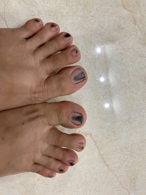 Giày đi êm nhưng form nhỏ nên chọn size 37 mà vẫn thấy hơi chật ( bình thường mình đi 36.5-37), mà đi giày xong là ko dám bỏ ra vì cái gì trong giày màu đen nó ra quá trời vậy shop ơi? Phải dùng xà bông chà chân mới ra