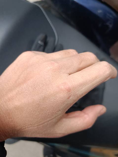 Size L mà ngón ngắn, chật, viền may thô. Tay tôi nhỏ, đeo size L rất thoải mái, riêng đôi này đeo đau hết tay. Lại tốn tiền tìm mua đôi khác. Size L mà ngón ngắn, chật, viền may thô. Tay tôi nhỏ, đeo size L rất thoải mái, riêng đôi này đeo đau hết tay. Lại tốn tiền tìm mua đôi khác.