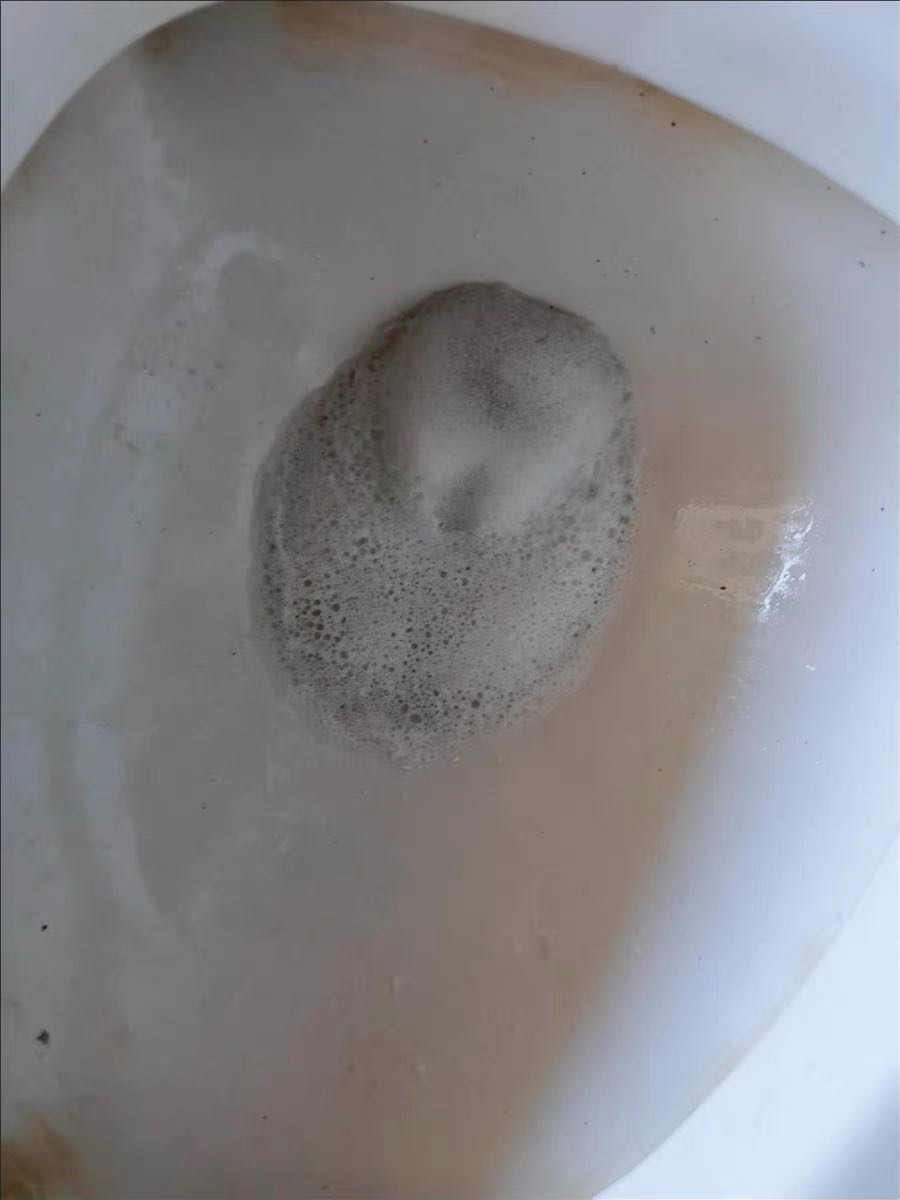 Shop uy tín, hàng chính hãng Yuhao, có kèm hướng dẫn rất chu đáo. Bồn cầu và bồn rửa đều tắc dềnh nước cả tuần nay, thử mấy loại không được mà chuyển qua loại này cái thông được luôn. Chi phí lại rẻ hơn nhiều so với thuê dịch vụ. Nói chung rất tốt, rất ưng!