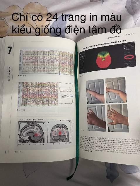 Sách bìa cứng nhưng giá hơi cao, in màu được 24trang (hình rất bình thường). Bán kiểu đọc quyền nên chỉ giảm 10-11% so với giá bìa 349k. Thiết kế bìa nhìn giống ố vàng và giống bị trầy xước (nếu là tôi thì tại logo nxb thế giới cho nền xanh bình thường). Phía sau bìa chữ mờ khó đọc, chỉ có giá thì rất rõ. Bên trong ruột thì ko canh đều trang. Giấy thì tốt.