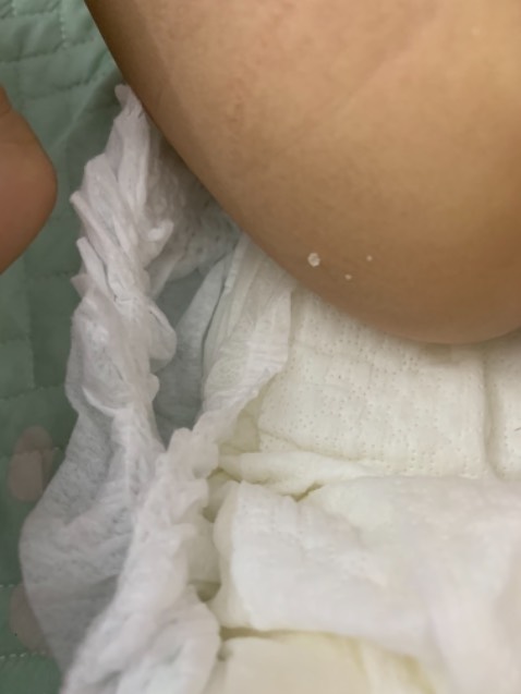 M đã dùng tã này rất nhiều lần nhưng lần đâu tiên mua tại đây thì bị hiện tượng mủn ra những hạt hạt dính ra người bé
Shop làm việc rất thiếu chuyên nghiệp, không có người để trả lời tin nhắn. Nhắn cho shop thì k nhận được phản hồi
Rất mong có câu trả lời từ shop vì mặt hàng dùng cho bé rất quan trọng