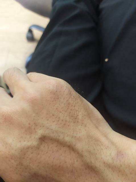 tôi mua bình gas và bật lửa nhưng bật lửa hư van bơm tôi muốn đổi nhưng shop k trả lời tôi mua bằng tiền chứ k phải lá mít . ae đừng mua của shop này rỉ gas có ngày nổ trên tay tôi bị bỏng nhẹ