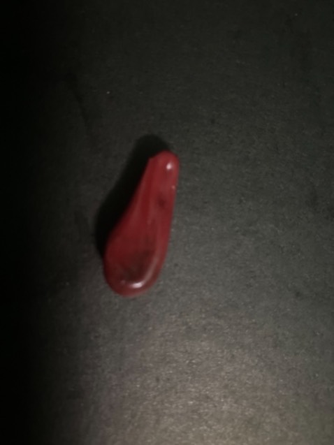 Để nghị Tiki cùng cơ sở bán hàng xem lại sản phẩm bán cho người tiêu dùng mua 3 hộp hôm nay mới bóc 1 hộp cho mẹ uống mà sản phẩm chảy nước các viên không còn hình dạng như ban đầu mà teo còn 1 nửa quăn keo như đã hết hạn từ lâu không biết do lỗi của nơi sản suất hay nơi bán dù date 4/1/2026 sản phẩm có bảo hành để nghị đổi mới các viên phải còn nguyên vẹn không chảy nước không thì phải hoàn tiền cho khách hàng mua của bên khác. Cả hộp đều bị còn 2 hộp chưa bóc