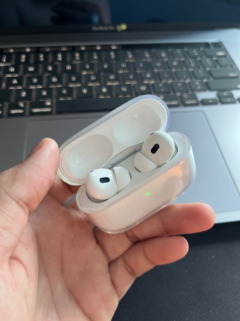 Ốp dày dặn.. chắc chắn.. cái nắp khá dể rớt ra nhưng này bệnh chung rồi… 🥹🥹