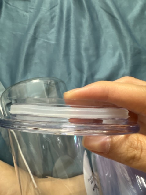 bị nứt nắp, xước nắp nhiều bị nứt nắp, xước nắp nhiều