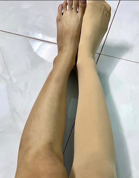 Chân mình cực nhiều khuyết điểm mà gần như che dc 100% Lúc đầu cũng đắn đo suy nghĩ, hàng về là thử liền mà quá sức tưởng tượng, quá ưng, co giãn tốt, che sẹo tốt, shop rep ib nhanh dễ thương Chân mình cực nhiều khuyết điểm mà gần như che dc 100% Lúc đầu cũng đắn đo suy nghĩ, hàng về là thử liền mà quá sức tưởng tượng, quá ưng, co giãn tốt, che sẹo tốt, shop rep ib nhanh dễ thương