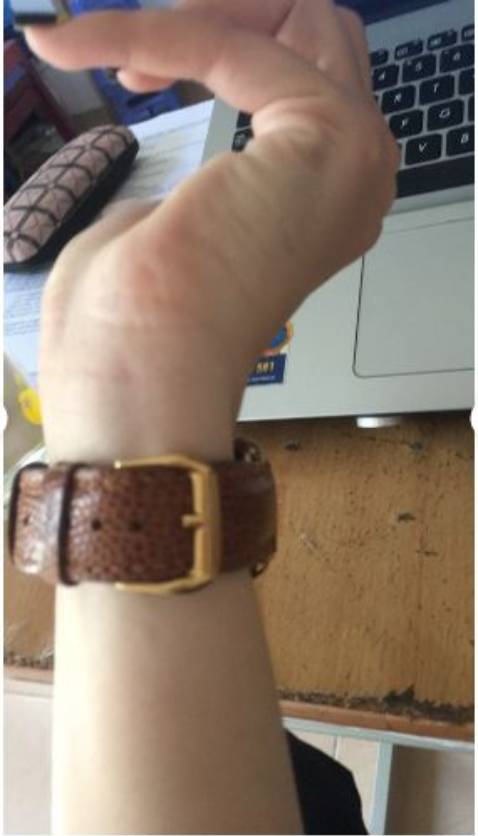 Dây rất đẹp. Độ mềm dẻo của da đà điểu cũng rất ok, co giãn tốt giúp bề mặt da không bị nứt khi uốn cong hay gấp lại mang lại độ bền vượt trội