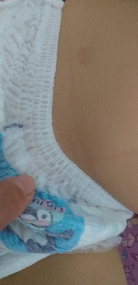 mới mặc chưa đc 30p mà bé đã bị hằn đỏ rồi. bỉm râtts cững. mình tính mua về để mặc ngủ giấc trưa thôi nhưng mới mặc caia đầu tiên đã thấy ko ổn rồi. khuyên mọi ng đừng mua