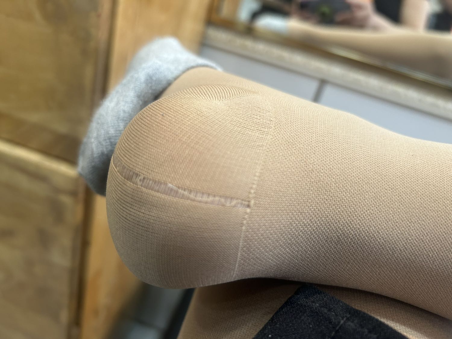 Mang xông bị sướt 1mot đường nên hơi buồn