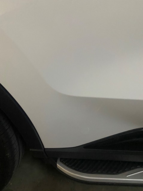 Lam bong va xoa xuoc hieu qua neu xuoc nhe nhu tren hinh.