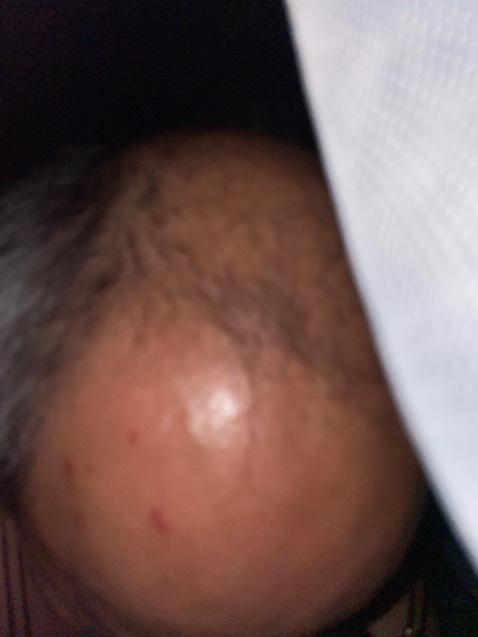 bật mấy hôm bắt được 3 con thiêu thân, còn bản thân nằm màn vẫn dính 12 vết muỗi đốt!!!