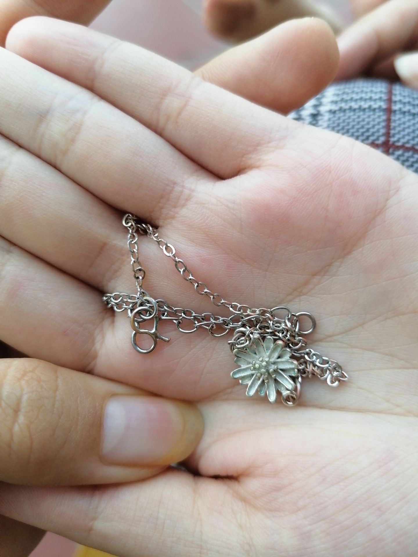 Ban đầu trắng sáng, ảnh sau 5 tháng đeo