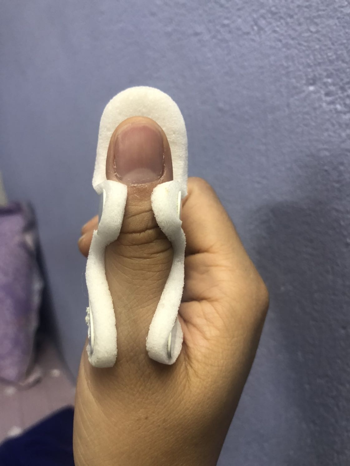 Nẹp cứng tay theo đúng yêu cầu nẹp cho ngón đúng phom nhưng do lúc tháo ra lắp vô phải chỉnh càng nẹp nên dễ gãy. Mình dùng dc 3 lần thì gãy như trong hình, chắc chừng dùng được 10 lần là hư rồi. Giá cũng mắc nếu chỉ dùng được vậy