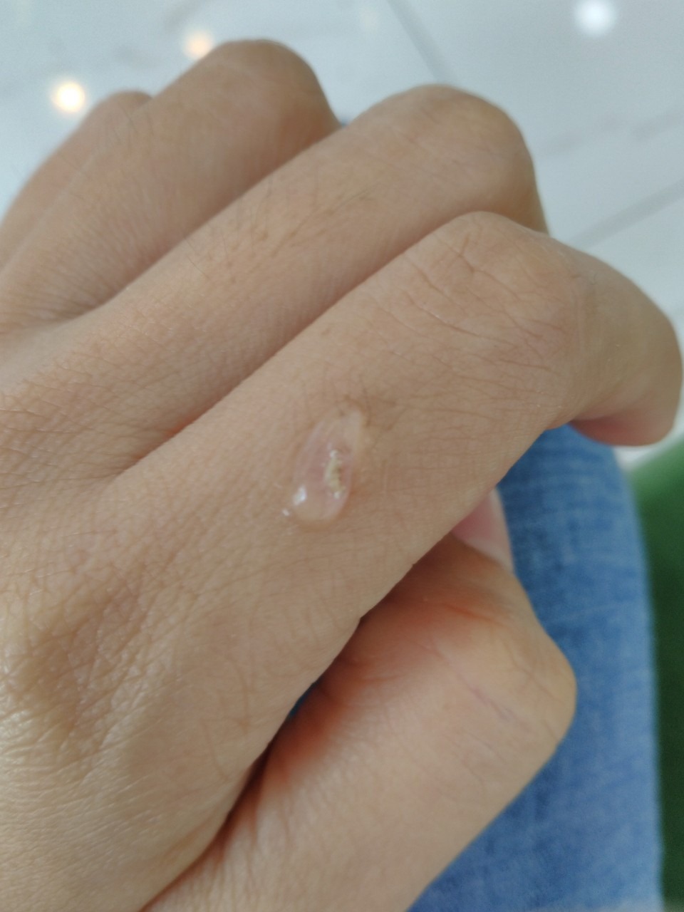 Trước có mua Rejuvasil của 1 shop trên ***, gel Rejuvasil mà kem trắng toát, thơm phức là mình thấy nghi hàng giả rồi. Lên web chính hãng bên Mỹ thấy gel màu trong suốt. Giờ Tiki có bán nên mình mua liền luôn, đúng chất gel trong, gần như không mùi, thoa lên vết sẹo thấy mát mát. Đợi vài tuần xem hiệu quả thế nào mình sẽ review thêm.