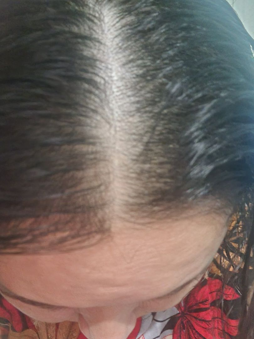 trong gia đình mình đã có người sử dụng,hy vọng sẽ có một mái tóc dày và khỏe,giao hàng nhanh