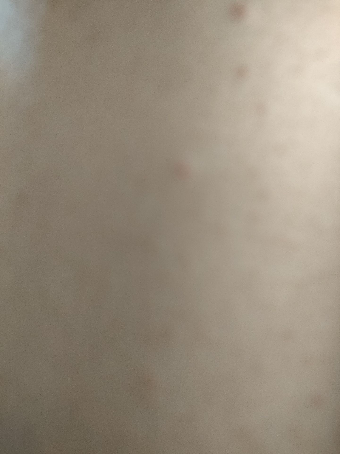 Mình mua 3 lọ về mà một lọ chảy hết dầu không còn giọt nào Mình mua 3 lọ về mà một lọ chảy hết dầu không còn giọt nào