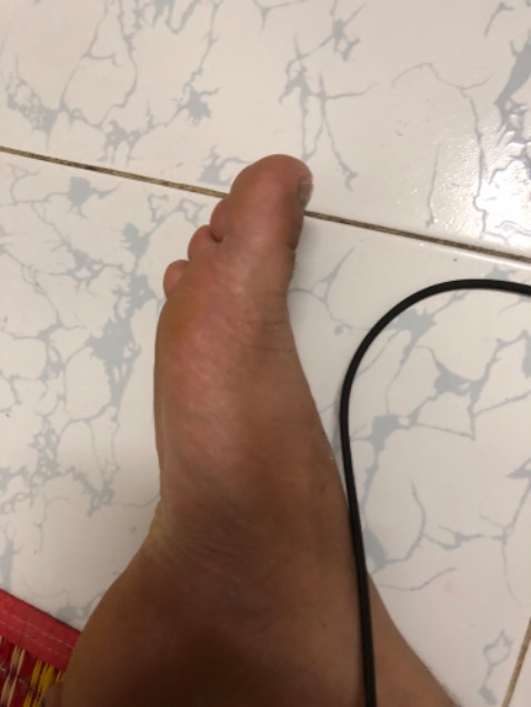 Cực tốt, sản phẩm tốt bảo vệ ôm cổ chân vừa, đã dùng 1 tháng vẫn tốt, sẽ ủng hộ shop