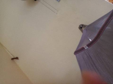 Ăn cũng được mà bị dín răng giá thì quá cao