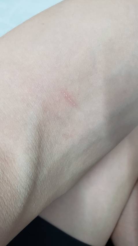 Sản phẩm OK nhưng giao hàng tệ quá. Móp, xước, chậm ...