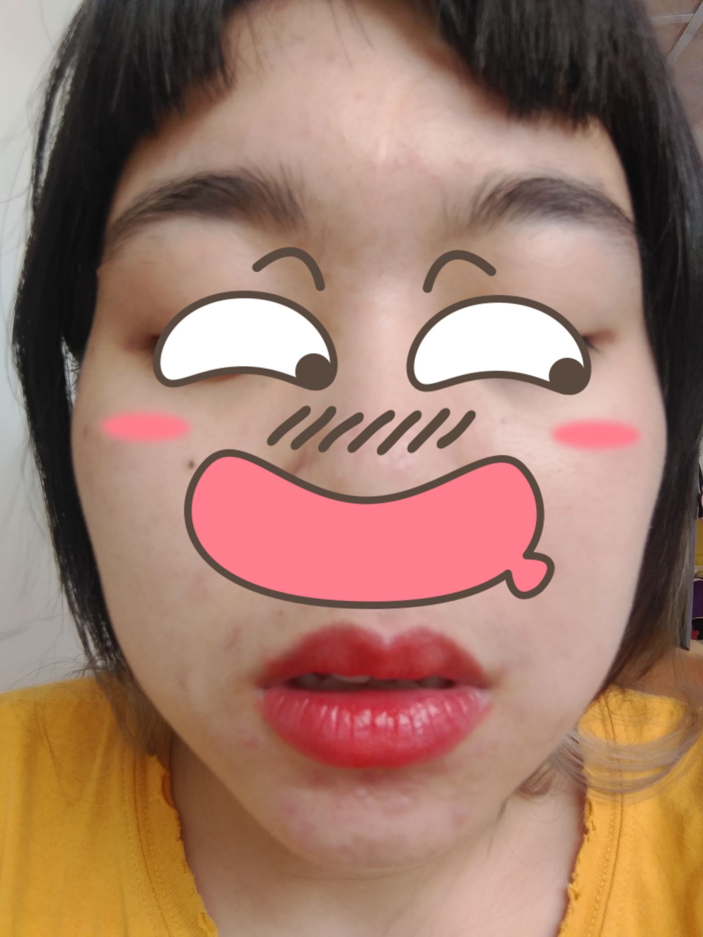 mặt hơi mụn, xài hết 1 cây rồi qd mua thêm 3 cây nữa, son này xài k bị thâm môi nữa, bóng lên màu nhẹ nhàng, nó tiệp vào da nên ăn uống vẫn còn lưu trên môi nên nhìn tự nhiên, nhìn trẻ trung năng động. có 85k mà chất lg ưng ý hơn cây son lì 300k của tui, ăn tới đâu dính tới đó, lâu trôi, xỉn và khô theo thời gian. chùi mãi ko ra , nên xài loại này có vẻ ổn áp