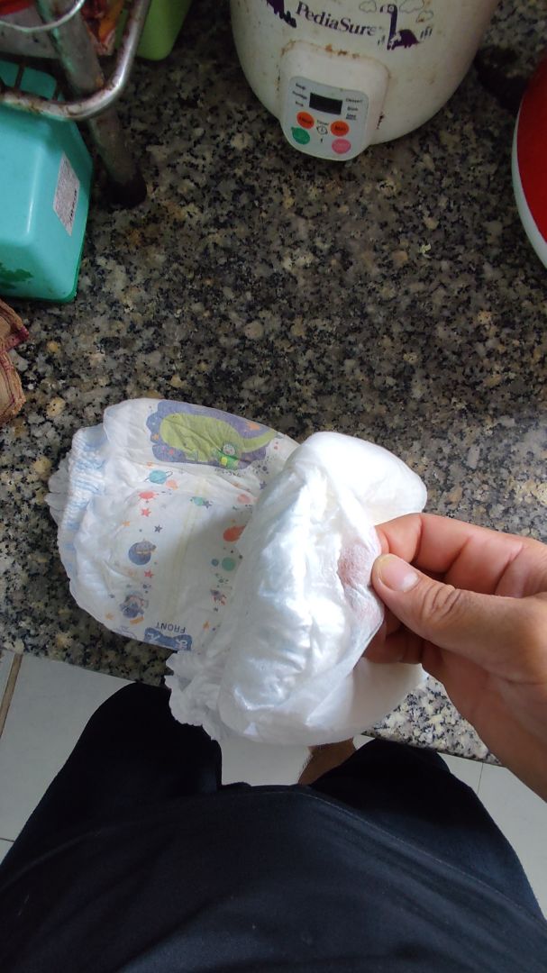 Quá thất vọng
1. Hàng giống hàng giả vì kiểu hàng xách tay kg được phân phối rõ ràng nên kg có templete Tiếng Việt ( đã check Monny Việt Nam)
2. Bao bì *** bám bụi dầy đặc
3. Shipper cọc lóc thái độ cục xúc ( Hàng kg được kiểm lấy kg lấy thì thôi 🤔🤔)
4. NSX,HSD, Lô SX kg giống hàng chính hãng ( in nhợt nhạt, nét xấu, kg đồng đều, căn lề giữa thay vì lề phải như hàng chính hãng mua ở s.thị)
5. Mặt tã mõng, khô ráp, thun khó chịu
Quá thất vọng. bao bì xé ra r có trả được không
đơn hàng 2 tôi sẽ kg nhận