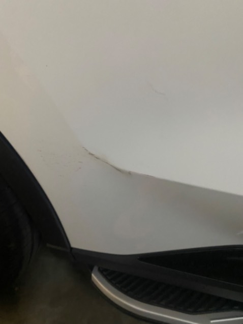 Lam bong va xoa xuoc hieu qua neu xuoc nhe nhu tren hinh.