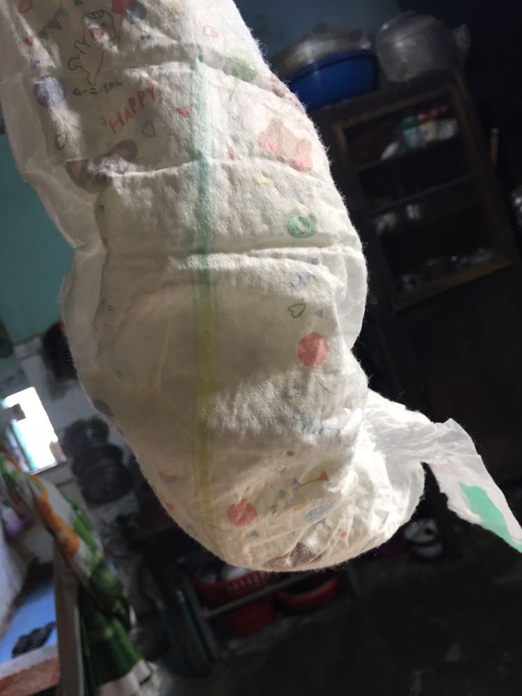 Sao hàng tiki giao lúc nào bill cũg bị dơ như vậy, hàng tiki trading check mã vạch thì ra nhưng cầm miếng bỉm ko giống với mua ở con cưng,, xưa giờ mang của moony ko có bị gì nhưng bé mang cái này mới 1 ngày mà bị hăm, miếng tã vón cục phía trước khôg hiển thị vạch phía sau, nhìn miếng tã giống hàg giả kém chất lượng
khui ra rồi chắc ko thể trả hàg đc, tiki có thể giải quyết đc ko?