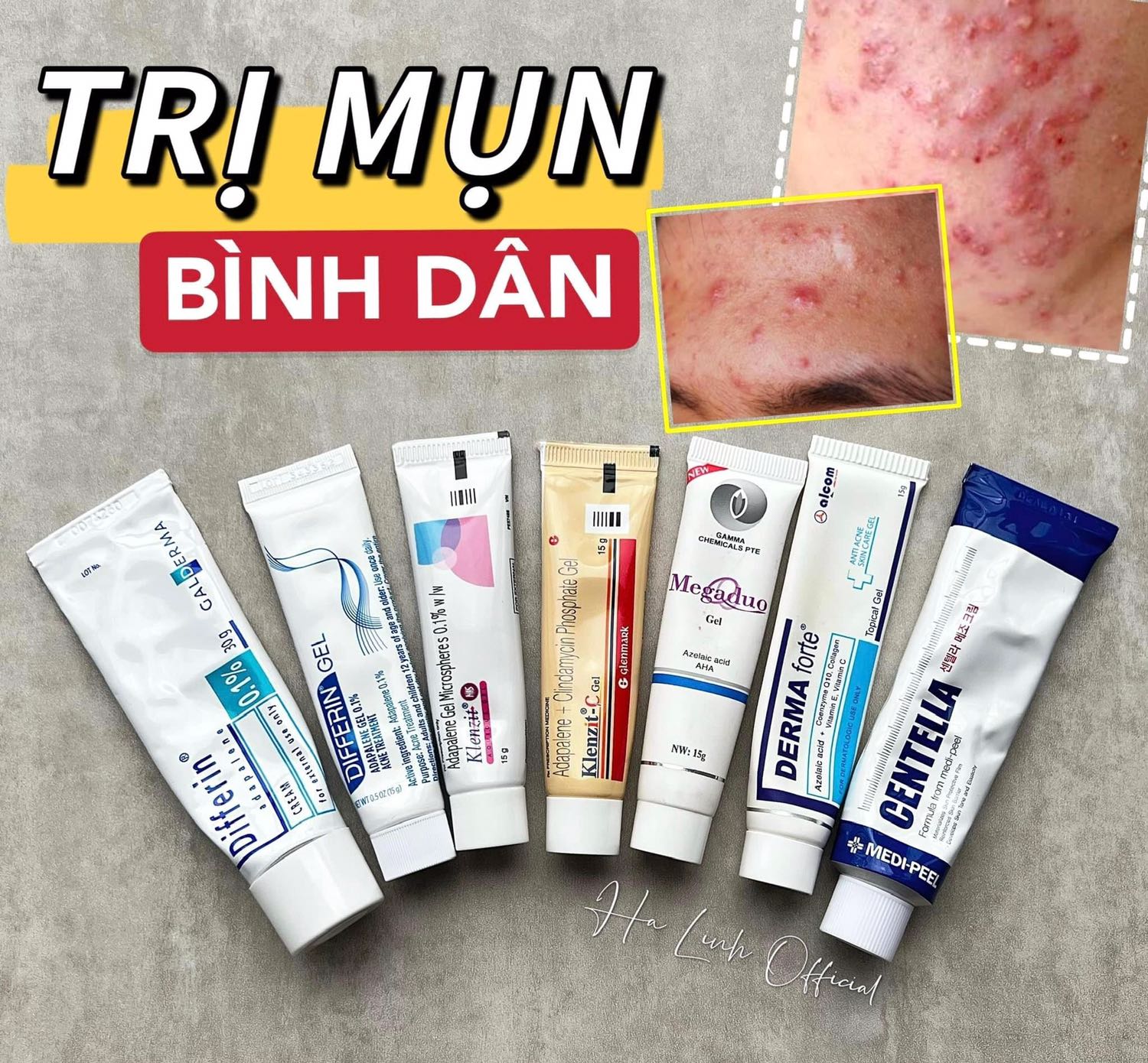 (TB) KICH HOAT TAI KHOAN NGAY, JACKPOT 35 TY VE TAY! Chi can kich hoat tai khoan Vietlott SMS trong 10 giay, ban da co the cham tay vao giac mo tro thanh ty phu. Con chan chu gi ma chua truy cap https://bit.ly/VietlottMBF de doi mat khau va mua ve ngay. LH 1900599822 (1,500d/ph) de duoc ho tro.