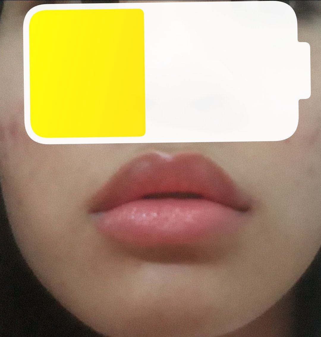 Đầu  tiên về phần vỏ rất chắc chắn k thể trừ điểm được. Nhưng  điều mình quan tâm nhất về chất lượng thì em này làm mình không hài lòng. Mùi rất kì, mình ngửi như mùi đất sét. Bôi nhiều lớp lên sẽ ra màu hồng cánh sen rất dìm(nếu không tẩy da chết). Chất son giống son gió nhưng chậm hơn.để tầm 1-2h môi bắt đầu hồng choét lên trông rất sợ. Hình ảnh dưới đây là môi mình sau khi tẩy da chết và bôi lớp mỏng lên( trông không quá đáng sợ nhưng 1 tgian sau lên màu k đc đẹp) nếu như muốn mua thì bạn chỉ nên bôi ở nhà nếu không sẽ k kiểm soát đc màu son. Son này rất lì luôn ấy. Trời càng lạnh nó lên màu càng nhanh. màu mình mua là cam san hô. Hi vọng nếu như cải thiện màu son này nhà sx sẽ cho thêm nhiều đỏ hơn là hồng