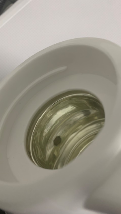 Mọi người cẩn thận khi mua ở shop này nha. Mang tiếng gian hàng chính hãng mà giao hàng bị lỗi. Bình nước giữ nhiệt mà ở trong có 3 vết rĩ sét như hình trông rất ghê. Vậy làm sao mà dám đựng nước vào mà uống. Tiền mất tật mang xứng đáng 1 sao.