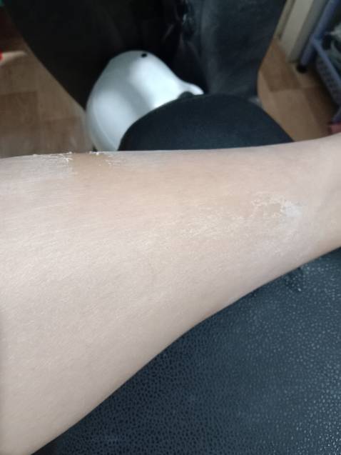 Mình đã sửa từ một sao lại thành năm sao.
Lúc đầu bôi lên 3 ngày liên tục da không có bong.
Chất kem thì hơi bết dính.
Bôi lên một tí thì nó khô, nhìn da rất quằn quại.
Tuy nhiên không nóng rát hay đỏ ửng hay ngứa gì cả.
Bây giờ thì ra đã bắt đầu bong nhé.
Phần da mới bong xong thì nó sáng hơn và mịn hơn.
Hài lòng nhé.