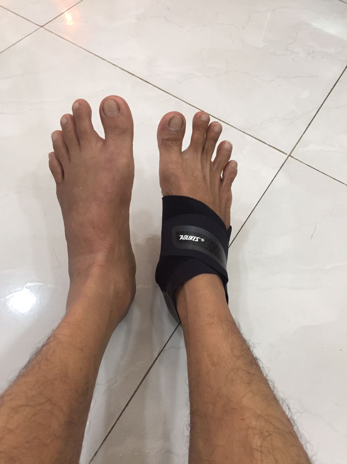 Đang cần sử dụng ,Đặt chân trái giao chân phải , thế này thì sao đây nhân viên kiểm duyệt đơn hàng của tiki làm việc không kỷ lưởng để kháck hàng cứ phản hồi ko tốt làm ảnh hưởng tới tiki