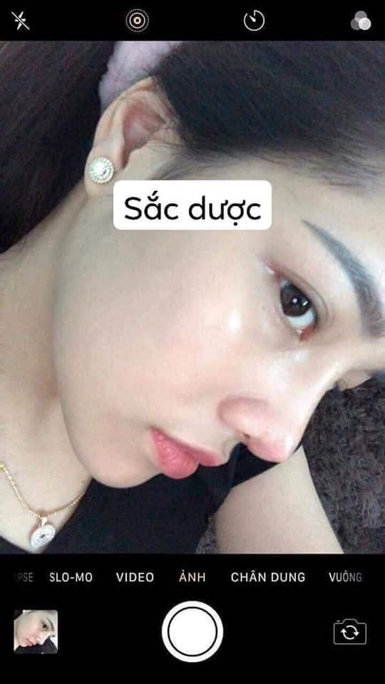 sorry shop nhé. hình ảnh không liên quan. Anh chị em nào bị mụn, nám, sạm, da xấu xí mà chưa tìm dc cách điều trị hiệu quả thì liên hệ em nhé
☎️ *** Zalo, fb 
- Đảm bảo hết mụn 100%, không hết mụn hoàn tiền.