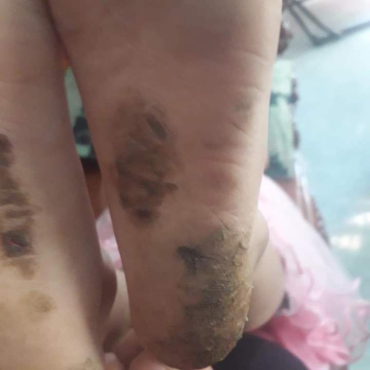 sản sẩm sài khá là ổn.bé nhà mình bị nứt nẻ chân rất nhiều nhưng đã khoi