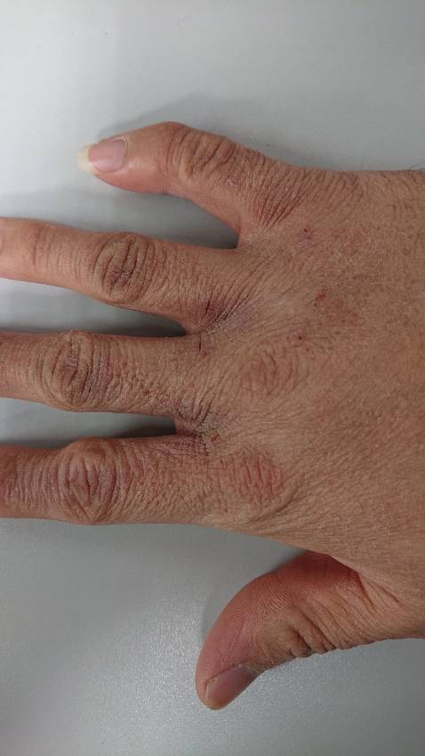 Có vẻ là da thật, sử dụng găng tay không vấn đề gì nhưng không hiểu sao găng tay bị nhuốm thuốc nhuộm rất kinh khủng, hôm lâu giặt thử mới biết, hết hơn 20 chậu nước không gột được màu đen nó thôi ra. Trót dùng tay trần giặt bị nhuộm luôn ra tay, không biết có phải vậy không mà từ hôm sau thấy da tay khô và nứt nẻ do lạnh (chưa bao giờ bị như thế này từ bé tới giờ)