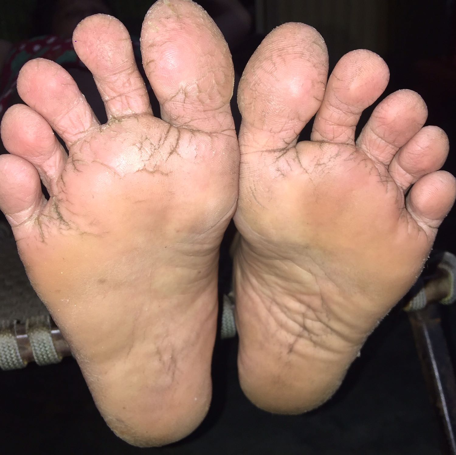 Mẹ mình mua hai kem nứt gót của Thorakao trên tiki ngày 21-12-2019.Ngày 23-12-2019 đã nhận được hàng , hàng hóa được bao bì cẩn thận ,đánh giá sự phục vụ bên bộ phận giao hàng của tiki là 5 sao?
Lúc đầu da chân của mẹ mình rất sần sùi,vì mùa đông nên càng nứt đến nỗi chảy máu.Mình vô tình search sản phẩm của Thorakao thì biết đến sản phẩm này.Sau hơn 10 ngày sử dụng mẹ mình nói rằng da chân mịn hơn,không còn nứt nẻ đến chảy máu nữa,nói chung là xài nhiều sản phẩm và cách trị nứt gót mà chưa thấy sản phẩm nào tốt bằng cái này.Kem thơm,giá bình dân vì là hãng của VN ,hiệu quả cao.Để mẹ mình xài hết hai tuýp mình review ảnh cho mọi người xem tiếp nhe❤️Review mình chân thật,không giả dối nha. Mẹ mình mua hai kem nứt gót của Thorakao trên tiki ngày 21-12-2019.Ngày 23-12-2019 đã nhận được hàng , hàng hóa được bao bì cẩn thận ,đánh giá sự phục vụ bên bộ phận giao hàng của tiki là 5 sao?
Lúc đầu da chân của mẹ mình rất sần sùi,vì mùa đông nên càng nứt đến nỗi chảy máu.Mình vô tình search sản phẩm của Thorakao thì biết đến sản phẩm này.Sau hơn 10 ngày sử dụng mẹ mình nói rằng da chân mịn hơn,không còn nứt nẻ đến chảy máu nữa,nói chung là xài nhiều sản phẩm và cách trị nứt gót mà chưa thấy sản phẩm nào tốt bằng cái này.Kem thơm,giá bình dân vì là hãng của VN ,hiệu quả cao.Để mẹ mình xài hết hai tuýp mình review ảnh cho mọi người xem tiếp nhe❤️Review mình chân thật,không giả dối nha.