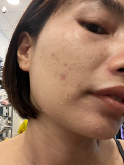 Kem chống này gì mà bôi lớp kem dưỡng hoặc lớp sirum để khô xong bôi thêm lớp chống nắng là giống như kì đi hết những chất vừa bôi đi í. Phải bôi chống nắng nhanh, ko thôi làm chậm chậm là y như rằng kì ra 1 đống như trong hình đây. Chán thiệt sự, kem này chỉ thích hợp da chỉ bôi 1 mình kem chống nắng thôi nhé
