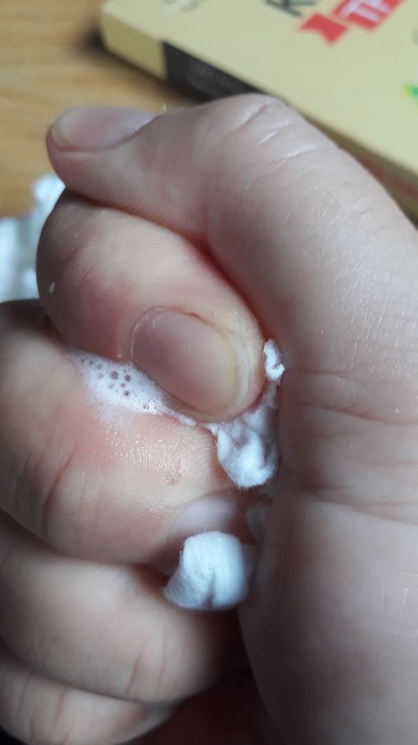 nói là khăn ướt tiệt trùng tinh khiết cho bé mà chưa thấy sản phẩm khăn ướt nào kinh dị như vậy. nhớt nhợt, bọt bèo thấy gớm. lau *** cho bé còn ko dám nữa