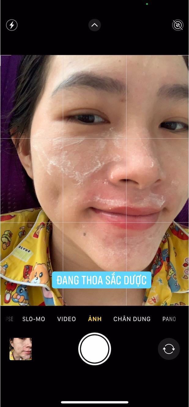 sorry shop nhé. hình ảnh không liên quan. Anh chị em nào bị mụn, nám, sạm, da xấu xí mà chưa tìm dc cách điều trị hiệu quả thì liên hệ em nhé
☎️ *** Zalo, fb 
- Đảm bảo hết mụn 100%, không hết mụn hoàn tiền.