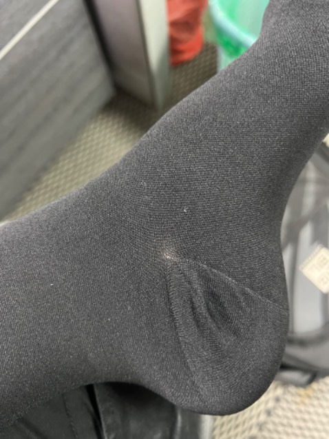 Mình đi tất rồi mới đọc hướng dẫn sử dụng, trong đó ghi hướng dẫn đi tất đúng cách :D. Tất đeo áp lực nha. Mình mua cho mẹ.