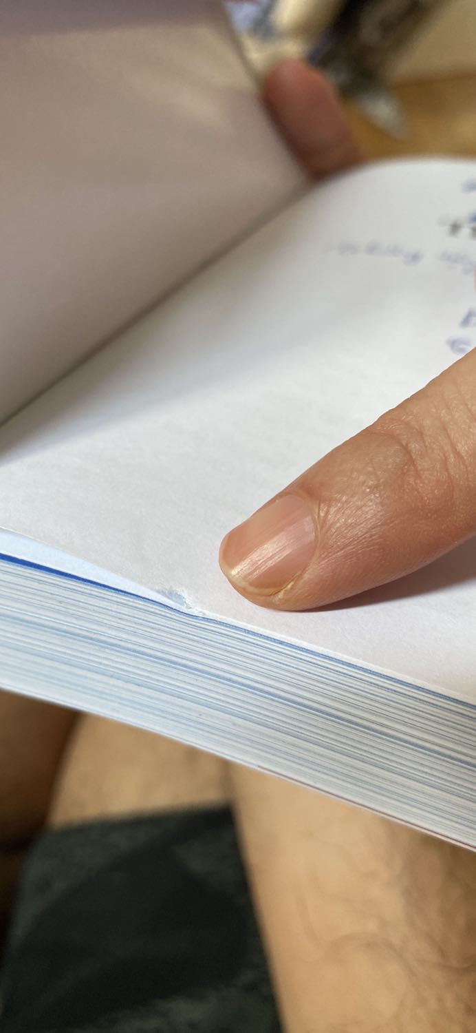 Sách bị rách, móp, nhăn, cũ, tôi tính mua làm quà nhưng chất lượng như vậy khiến tôi rất thất vọng.
Tôi đã lỡ ghi đề tặng cho cả 2 quyển sách, nhưng khi kiểm tra kỹ tôi mới thấy quá nhiều lỗi như hình và tôi không thể mang tặng quyển sách kém chất lượng như vậy để ảnh hưởng uy tín của mình.
Tôi mong Tiki sẽ có chính sách kiểm soát chất lượng đối với sách được bán ra để đảm bảo sự hài lòng của khách hàng. 
Xin cám ơn.
Tạ Minh Hà