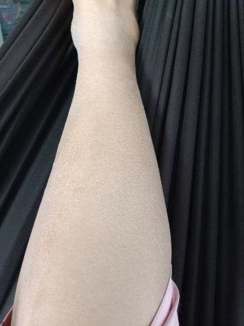 Mình đã sửa từ một sao lại thành năm sao.
Lúc đầu bôi lên 3 ngày liên tục da không có bong.
Chất kem thì hơi bết dính.
Bôi lên một tí thì nó khô, nhìn da rất quằn quại.
Tuy nhiên không nóng rát hay đỏ ửng hay ngứa gì cả.
Bây giờ thì ra đã bắt đầu bong nhé.
Phần da mới bong xong thì nó sáng hơn và mịn hơn.
Hài lòng nhé.