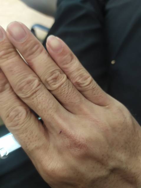 tôi mua bình gas và bật lửa nhưng bật lửa hư van bơm tôi muốn đổi nhưng shop k trả lời tôi mua bằng tiền chứ k phải lá mít . ae đừng mua của shop này rỉ gas có ngày nổ trên tay tôi bị bỏng nhẹ