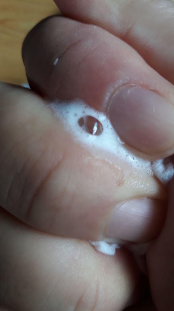 nói là khăn ướt tiệt trùng tinh khiết cho bé mà chưa thấy sản phẩm khăn ướt nào kinh dị như vậy. nhớt nhợt, bọt bèo thấy gớm. lau *** cho bé còn ko dám nữa