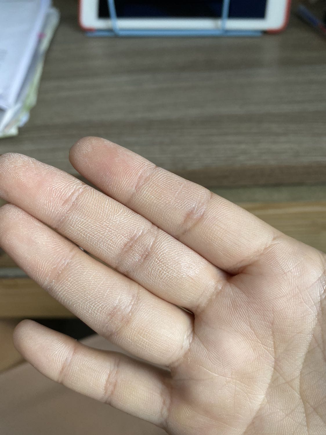 Mùi nhẹ dịu dễ chịu
Cảm giác đánh lên mặt k ăn da như xài phấn bị mốc mặt, nếu sờ lên mặt nó sẽ trôi ra
Chắc do da mình k hợp
Còn đây là tay mình dính kem sau vài phút nó khô lại