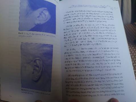 Sách bị quăn góc. Còn nội dung để mình chụp cho các b tham khảo nhé.