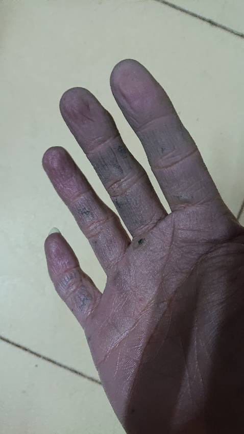 Có vẻ là da thật, sử dụng găng tay không vấn đề gì nhưng không hiểu sao găng tay bị nhuốm thuốc nhuộm rất kinh khủng, hôm lâu giặt thử mới biết, hết hơn 20 chậu nước không gột được màu đen nó thôi ra. Trót dùng tay trần giặt bị nhuộm luôn ra tay, không biết có phải vậy không mà từ hôm sau thấy da tay khô và nứt nẻ do lạnh (chưa bao giờ bị như thế này từ bé tới giờ)