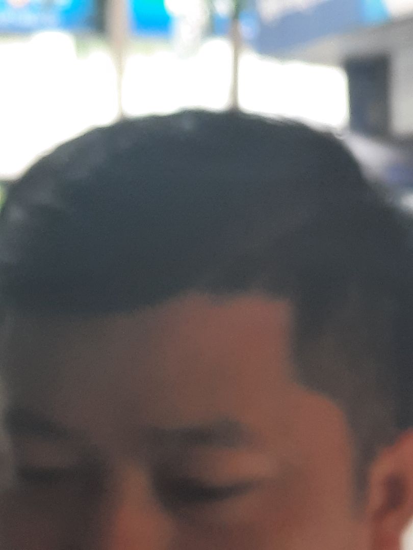 Sản phẩm tốt  có tác dụng sau 3 tháng sử dụng. đánh giá tốt cho người bị rụng tóc nhiều hoặc hói nhẹ Sản phẩm tốt  có tác dụng sau 3 tháng sử dụng. đánh giá tốt cho người bị rụng tóc nhiều hoặc hói nhẹ