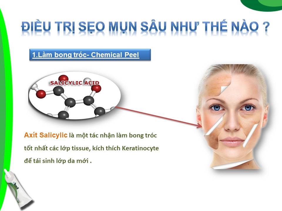 Acnesil Gel Silicone Cho Giải Pháp Hiệu Quả Cho Sẹo Mụn 10g