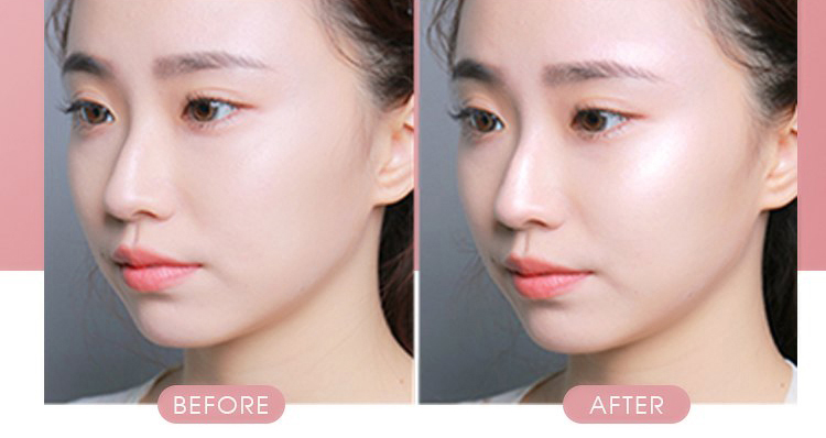 Bộ sản phẩm Dưỡng ẩm trắng da căng mọng